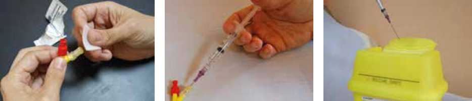 Injection into cannula
